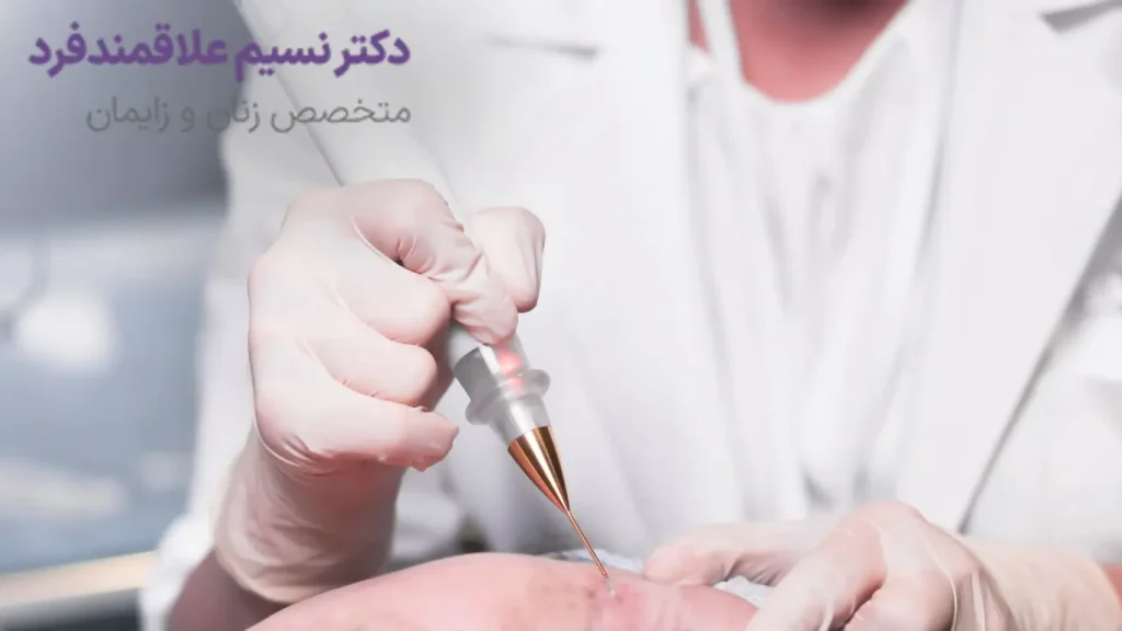 چه کسانی کاندیدای مناسب برای کاریوتراپی هستند؟