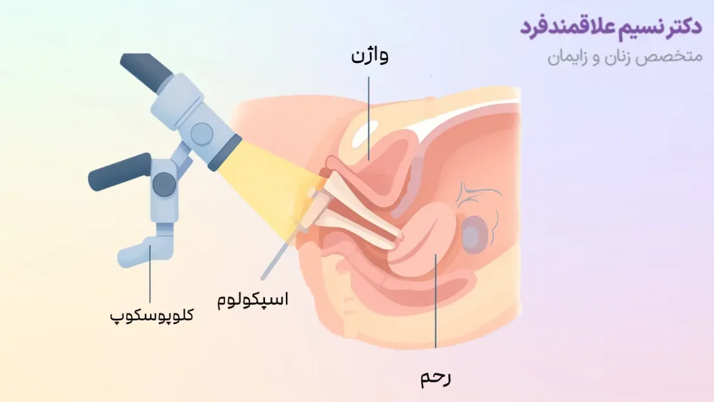 عوارض کولپوسکوپی