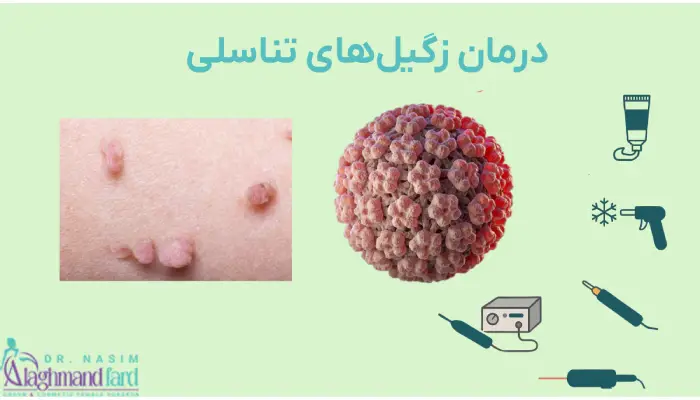 درمان زگیل تناسلی