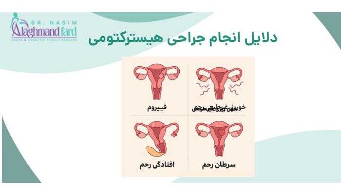 دلایل انجام جراحی هیسترکتومی