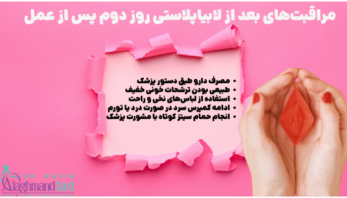 مراقبت های بعد از لابیاپلاستی روز دوم پس از عمل