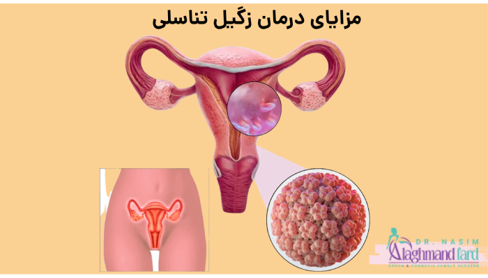 مزایای درمان زگیل تناسلی