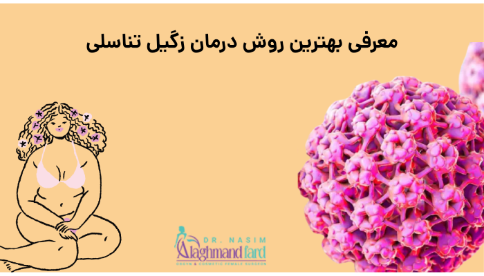 معرفی بهترین روش درمان زگیل تناسلی