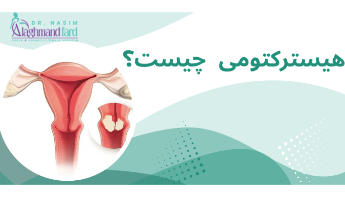 هیسترکتومی چیست