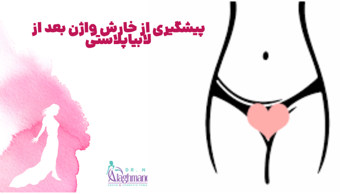 پیشگیری از خارش واژن بعد از لابیاپلاستی