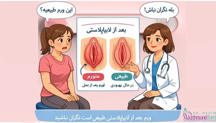 ورم بعد از لابیاپلاستی